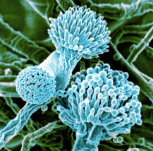 Aspergillus under a microscope